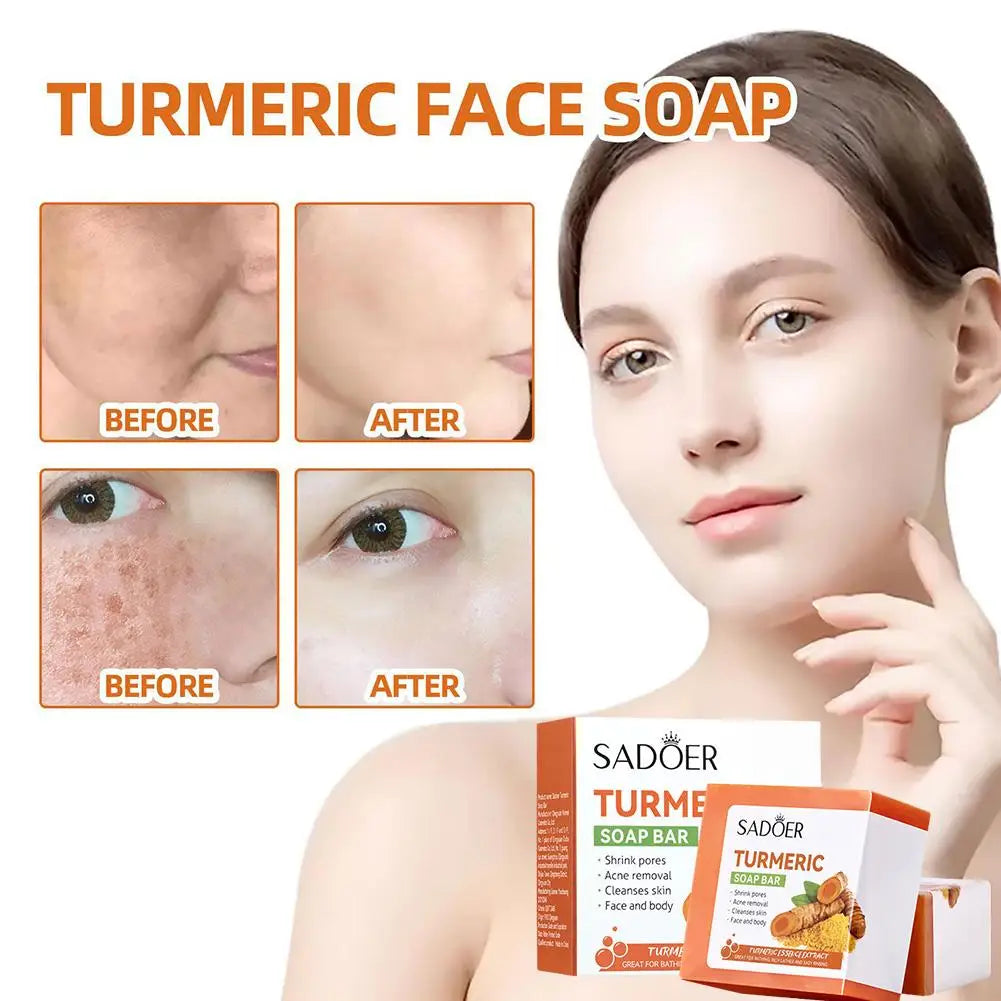 Turmeric Soap Face Cleansing Anti Acne Skin Brighten Dark Body Ginger Remove Essential Pimples Bath Lightening Spot Oil Han X1F9