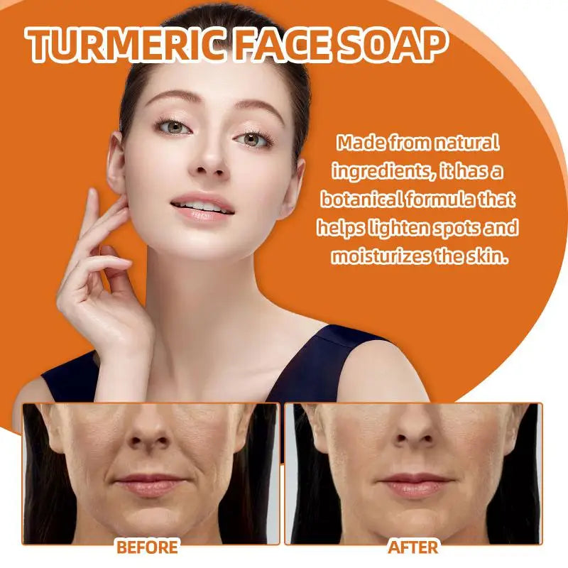 100g Turmeric Soap Face Cleansing Anti Acne Skin Brighten Dark Lightening Pimples Essential Handmade Ginger Spot Oil Remove F4L9