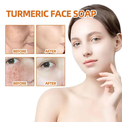 100g Turmeric Soap Face Cleansing Anti Acne Skin Brighten Dark Lightening Pimples Essential Handmade Ginger Spot Oil Remove F4L9